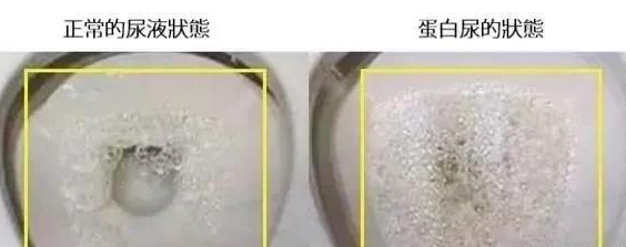 肾不好的人有什么表现 人肾不好身体有什么反应