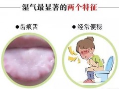 湿气重的人有哪些症状 有这些基本症状