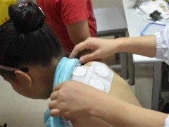 三伏贴能治肩周炎吗 三伏贴能治腰肌劳损吗