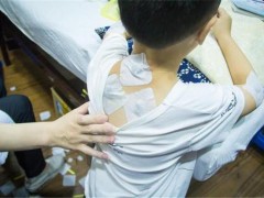 三伏贴配方都一样吗 三伏贴的作用是什么