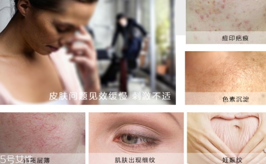 德国krauterhof蜗牛精华膏效果怎么样? 德国krauterhof蜗牛精华膏效果怎么样?