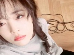 光子嫩肤要注意什么 光子嫩肤后如何保养