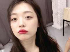 激光祛痘印每次要间隔多久 激光祛痘印适合什么季节做