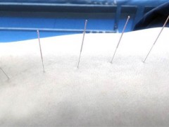针灸减肥疼吗 针灸减肥每天都要扎吗