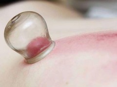 腹部拔罐减肥拔哪里 拔罐减肥包含哪些方法