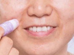 怎么去除嘴角皱纹 去除嘴角皱纹的方法