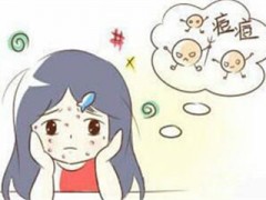青春痘的治疗方法