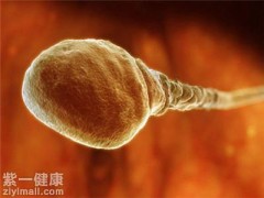 精子质量检查报告如何看 教你正确看报告