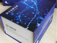 天门冬氨酸转移酶高的罪魁祸首 专家为你揭秘真相