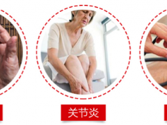 痛风是什么引起的 详解痛风及其原因