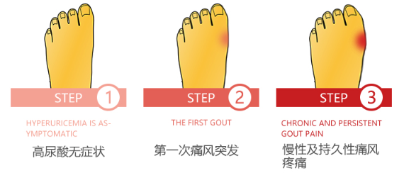 痛风的症状