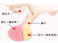 女性催乳素偏高会不孕吗 如何降低催乳素