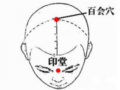 全面解析拔罐穴位图