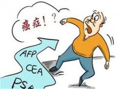 甲胎蛋白偏高的原因 解析造成的四大因素