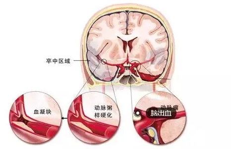 QQ截图20211105151324
