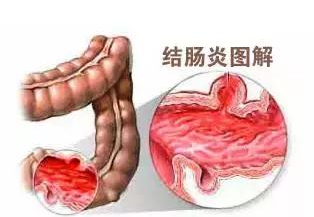 QQ截图20211106142731