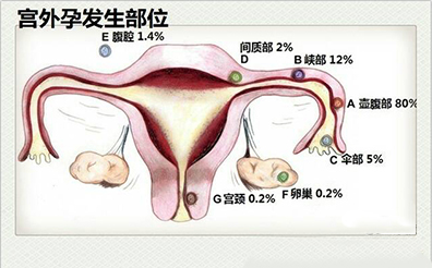 QQ截图20211106143518