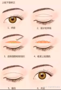 QQ截图20211107155248