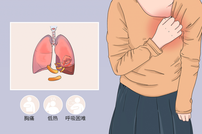 胸膜炎可以自愈吗图片