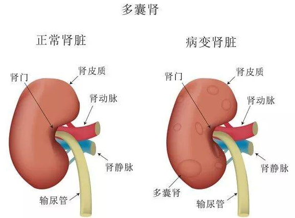 QQ截图20211108135125