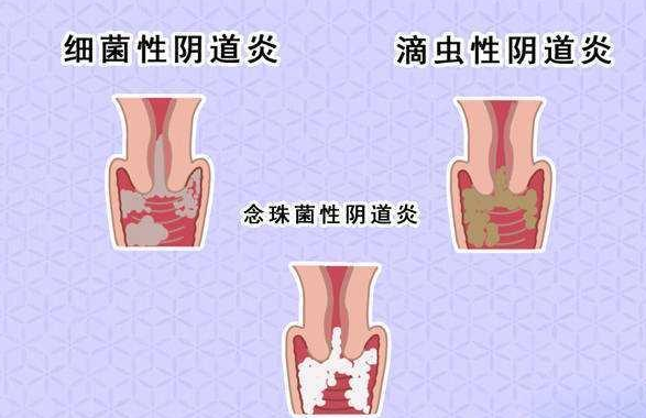 QQ截图20211108141405