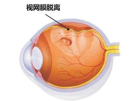 QQ截图20211108143410