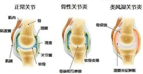 QQ截图20211116094214