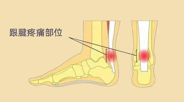 脚筋疼