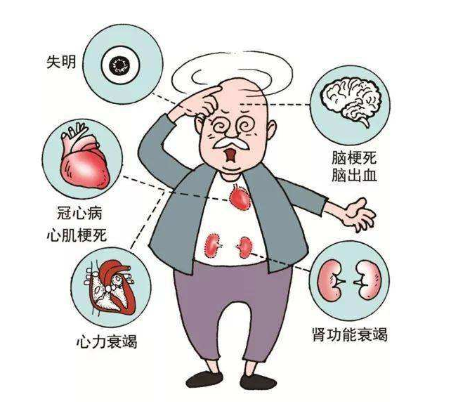 高血压