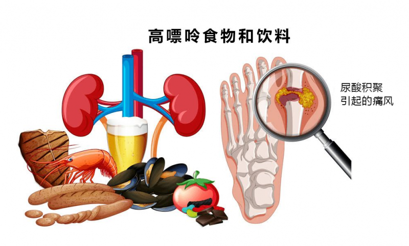 高尿酸吃什么中药呢
