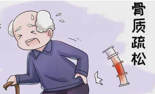 骨质疏松