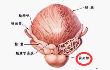 前列腺炎