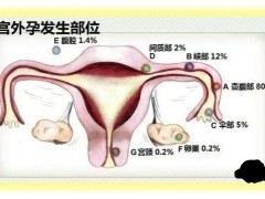 什么原因导致宫外孕