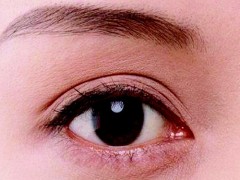 眼睑水肿症状