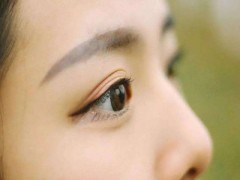 怎样去除眼角纹