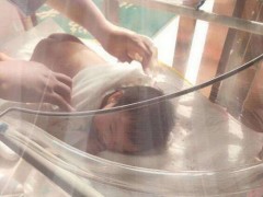 婴儿日光浴的时间