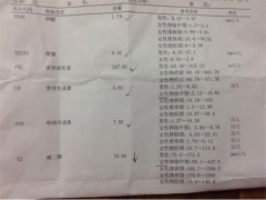 雌激素低是什么原因造成的