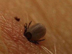 蜱虫咬人后有什么症状