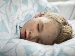 怎样去掉黄褐斑效果好