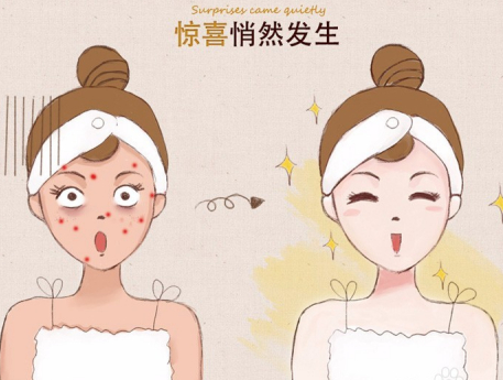 祛痘小妙招