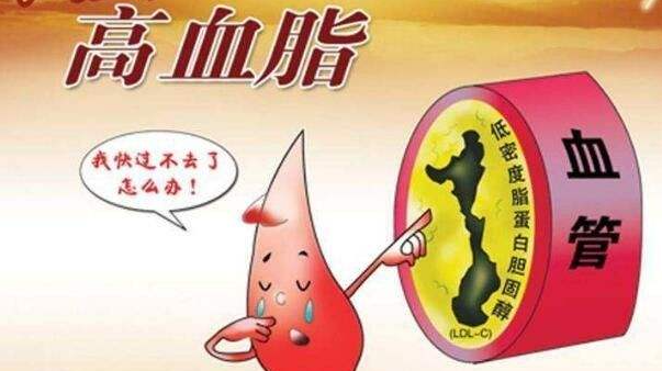 血脂高