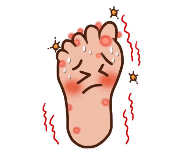 脚气