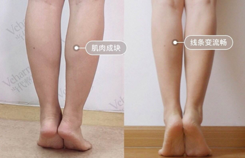 瘦腿针