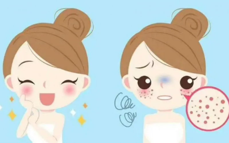 怎么收毛孔