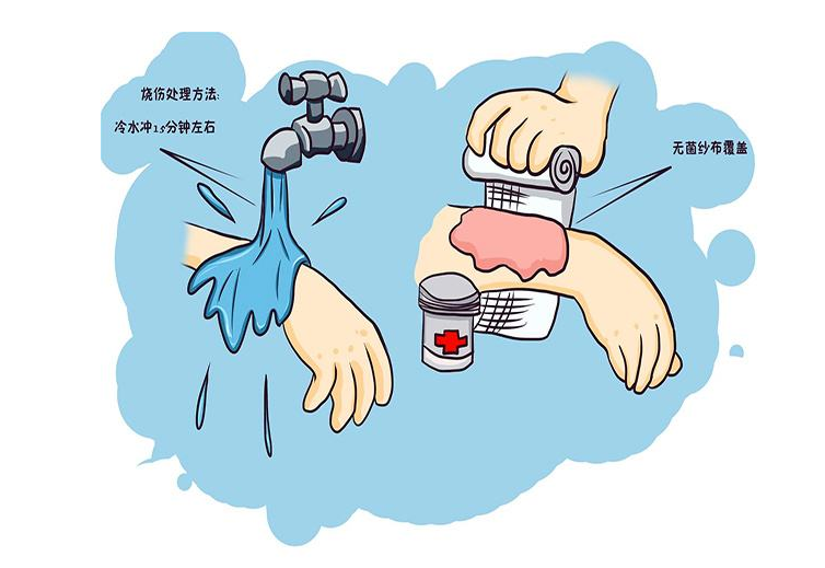烫伤怎么办