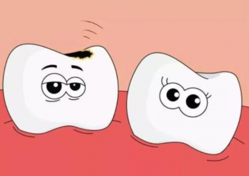 蛀牙是怎么形成的 揭秘导致蛀牙出现的四大原因