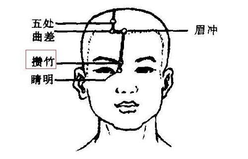 攒竹的准确位置图视频 按摩攒竹的功效