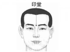 印堂的准确位置图 印堂的准确位置图和作用