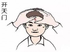开天门的作用 开天门是什么意思