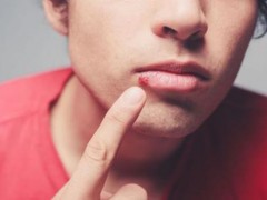 嘴角起泡是怎么回事 嘴角起泡如何快速消除